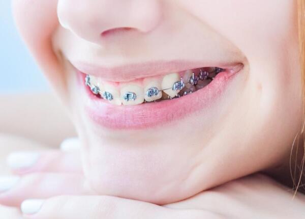 成人声波电动牙刷使用禁忌1