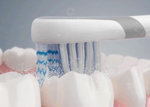 电动牙刷刷牙好吗？真的比手动牙刷更好吗？