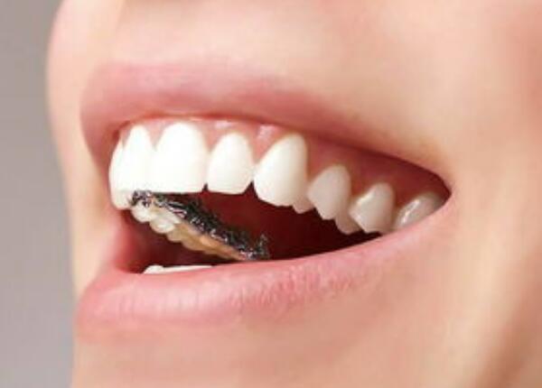 电动牙刷刷牙好吗