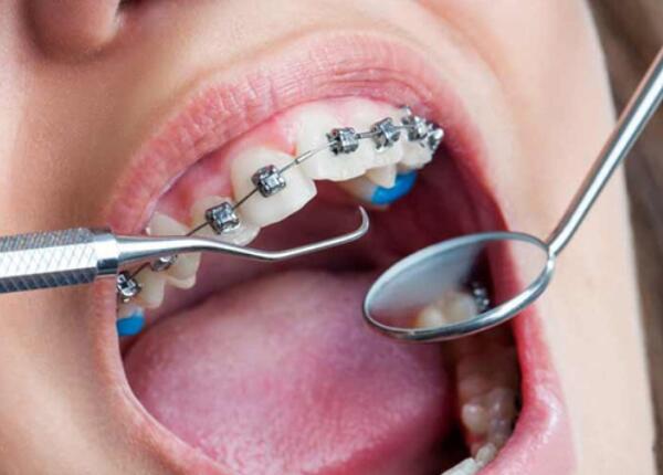 电动牙刷使用 电动牙刷