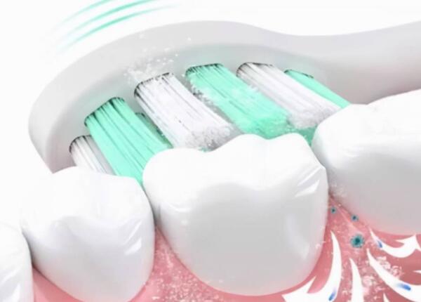 电动牙刷有什么用