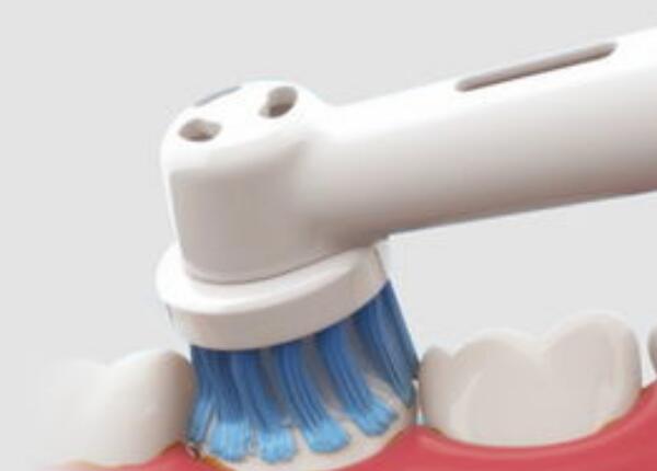 电动牙刷伤牙齿