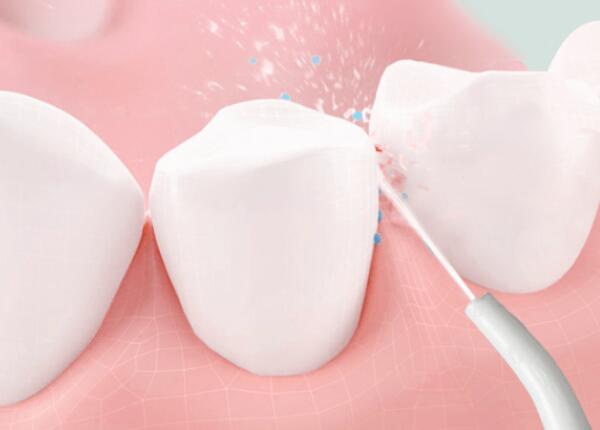 洗牙后用洗牙器好还是电动牙刷 洗牙后用洗牙器好还是电动牙刷