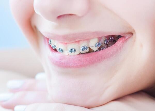 戴了牙套使用电动牙刷方法 戴了牙套怎么使用电动牙刷