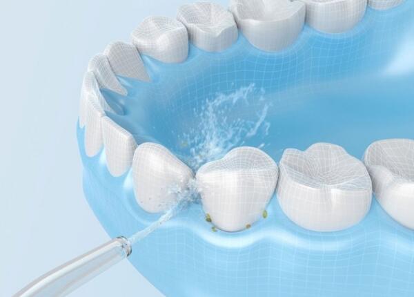电动冲牙器的正确使用方法