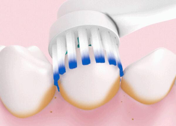 圆头电动牙刷儿童 圆头电动牙刷儿童